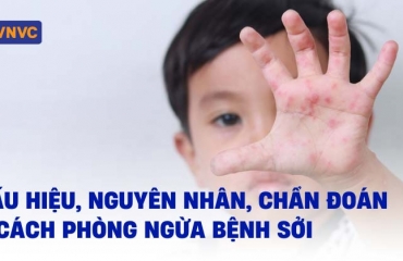 Bệnh sởi: Dấu hiệu, nguyên nhân, chẩn đoán và cách phòng ngừa